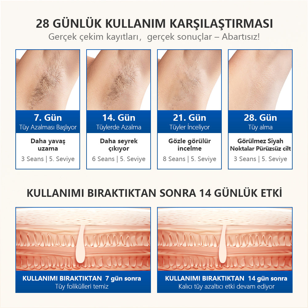 T16B-BKFASR-A1 - Mlay T16 Epilasyon Cİhazı  4  Başlıklı TÜm vücut, Yüz, Bikini, Yaşlılık Karşıtı